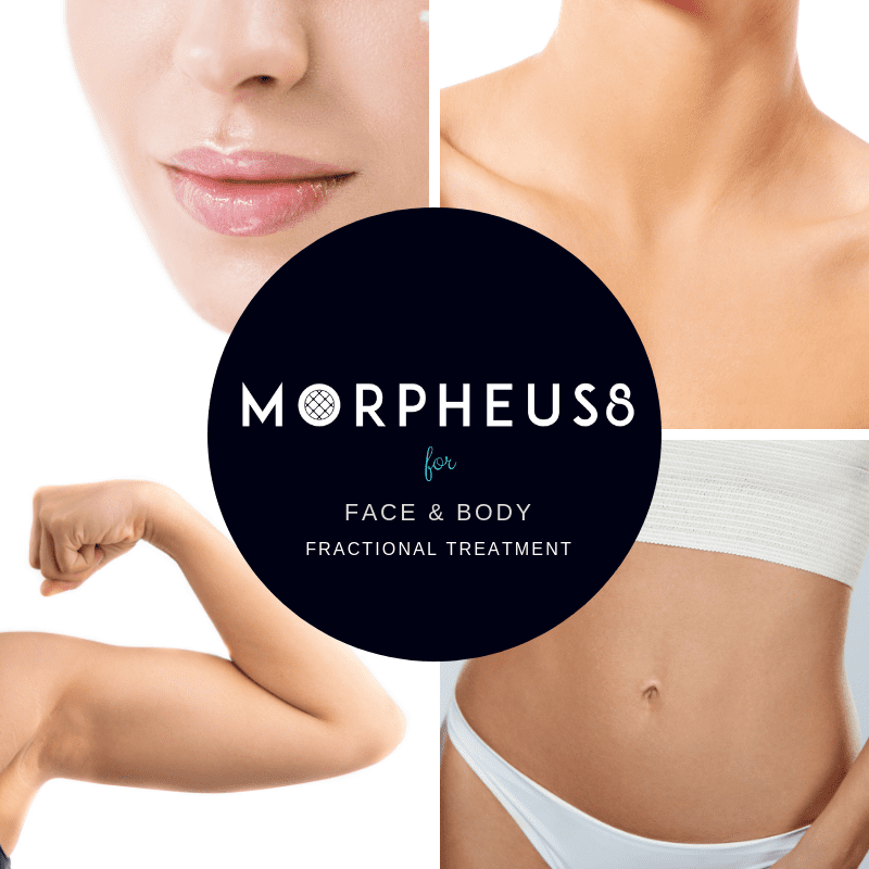 MorpheuS8 treatment